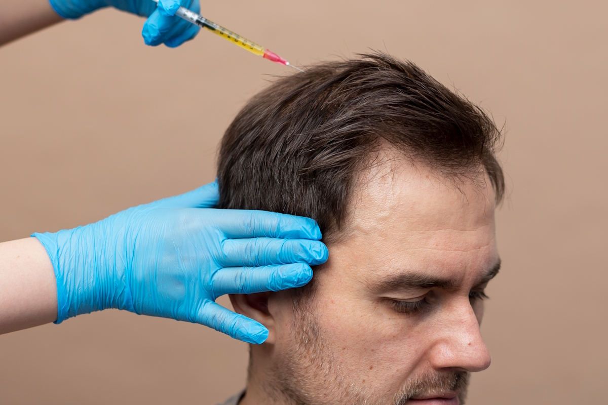 PRP Tedavisi Görseli